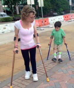 Valerie Pepe Teaches a Kid With AMC to Use Crutches the Correct Way